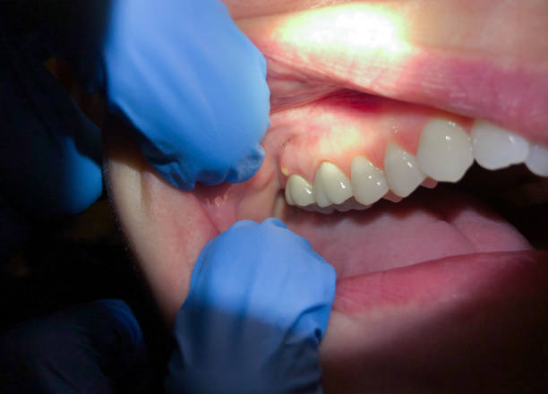 Best Emergency Root Canal Therapy in Fort Hunt, VA